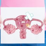 Prevención  del Cáncer de Cuello Uterino